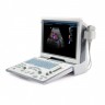 УЗИ аппарат Mindray DP-50 Color
